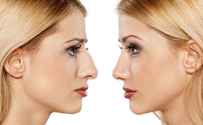 بهترین دکتر جراح بینی در کرج