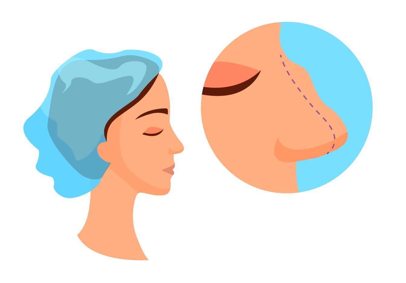 بهترین دکتر جراح بینی در کرج